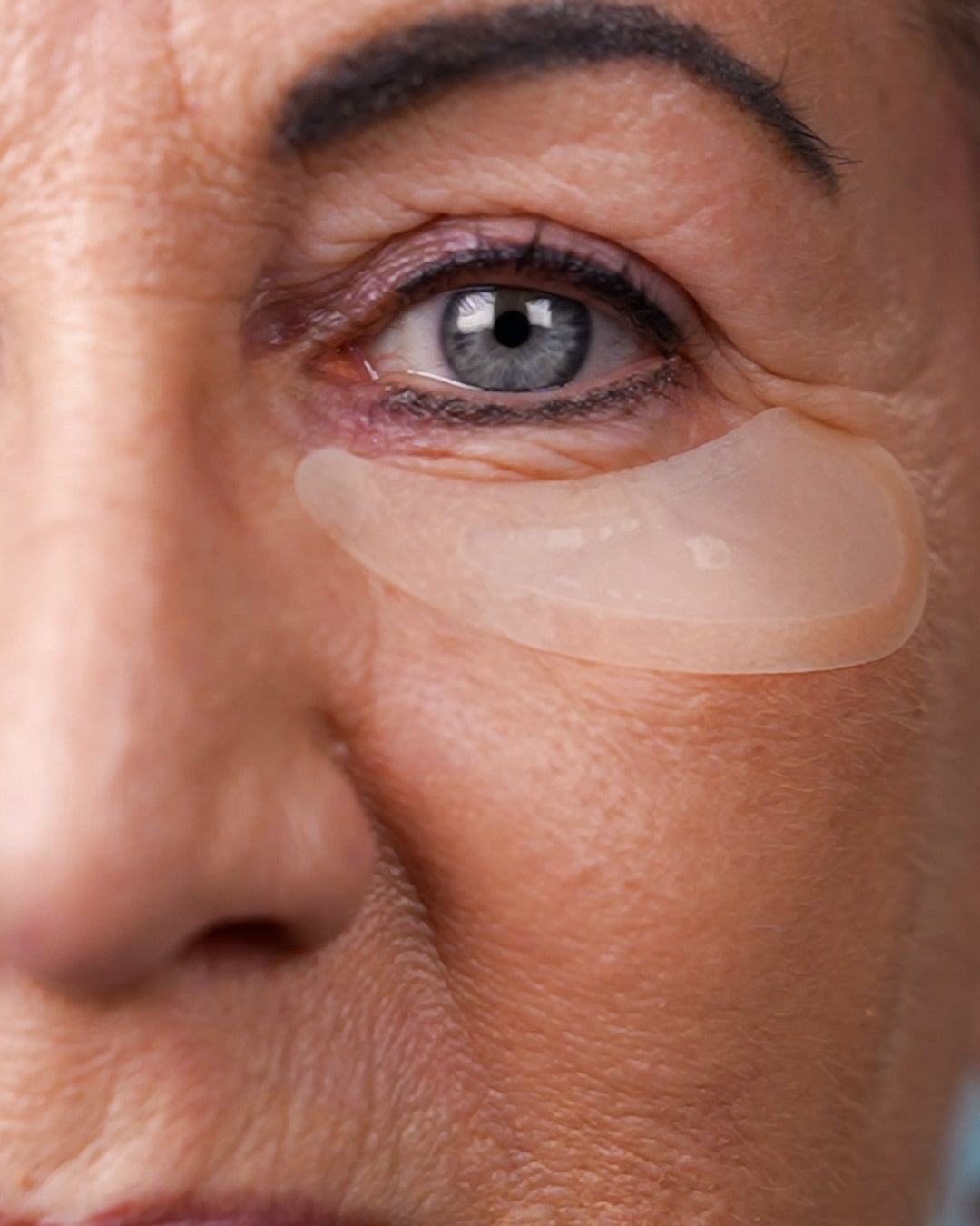 Akių zonos mikroadatinio terapijos rinkinys | Simfoninis